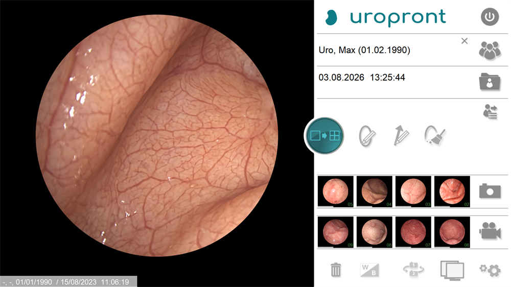 PES PILOT HDpro user interface during flexible cystoscopy